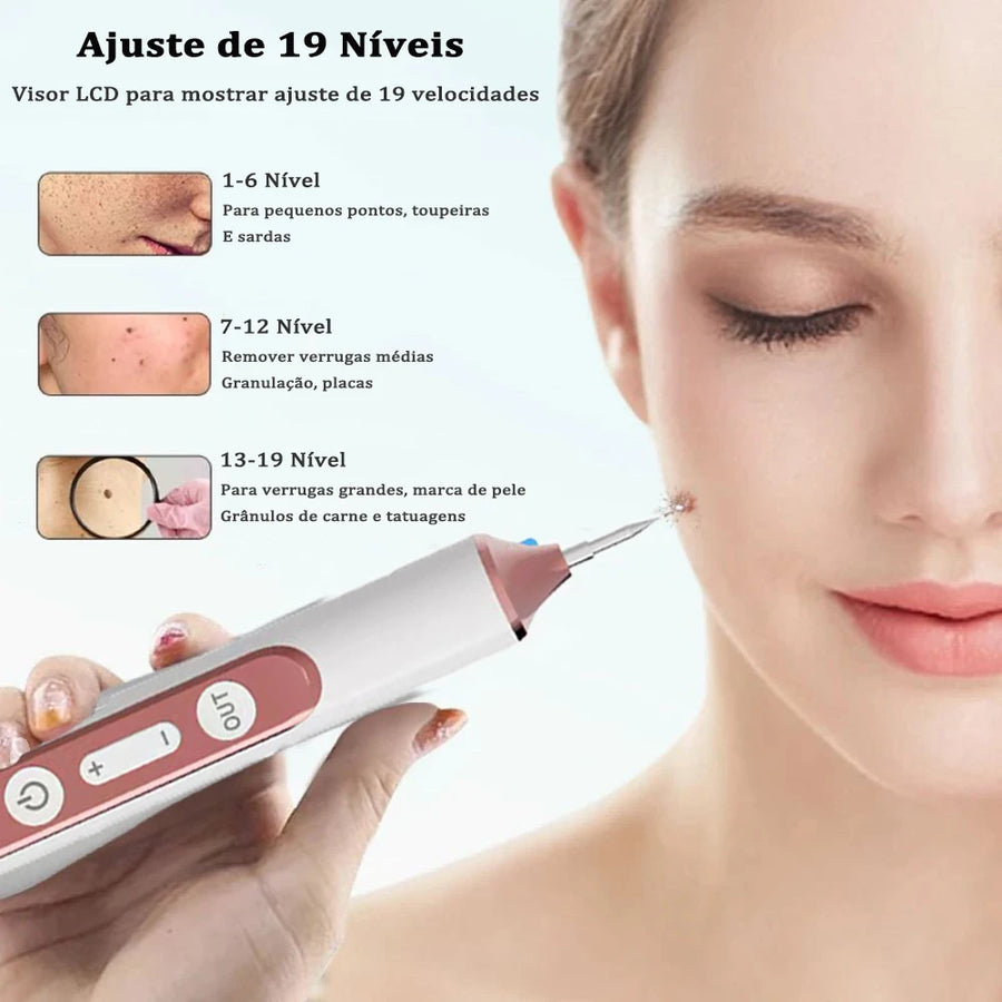 Caneta Removedora de Marcas de Pele - Skin Tag Remover